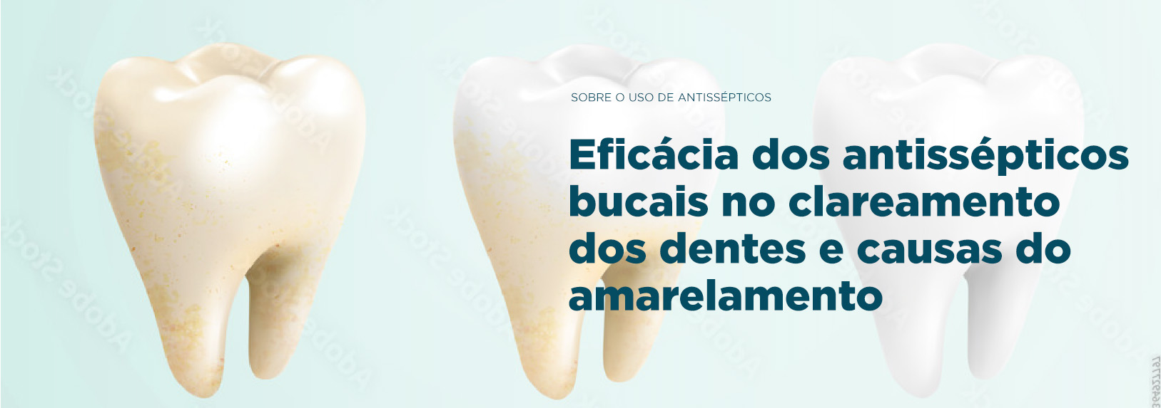 Banner Eficácia dos antissépticos bucais no clareamento dos dentes e causas de amarelamento | Odontologia | J&J